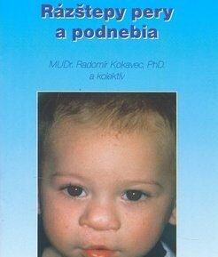 Rázštepy pery a podnebia - Radomír Kokavec