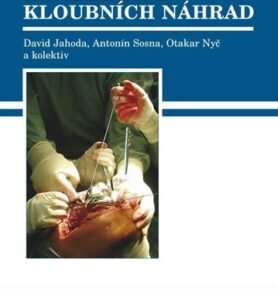 Infekční komplikace kloubních náhrad - David Jahoda