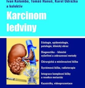 Karcinom ledviny - kolektiv autorů