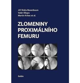 Zlomeniny proximálního femuru