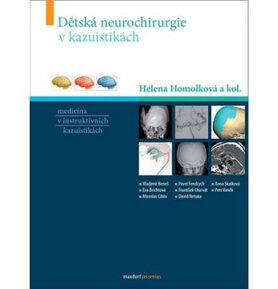 Dětská neurochirurgie v kazuistikách