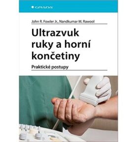 Ultrazvuk ruky a horní končetiny: Praktické postupy