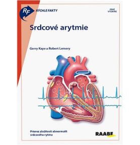 Srdcové arytmie