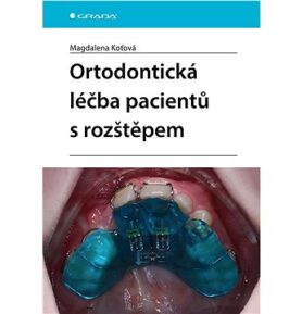Ortodontická léčba pacientů s rozštěpem