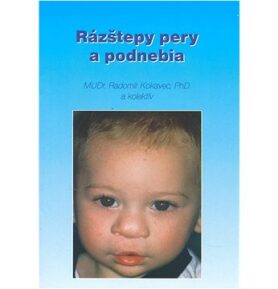 Rázštepy pery a podnebia