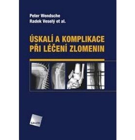 Úskalí a komplikace při léčení zlomenin