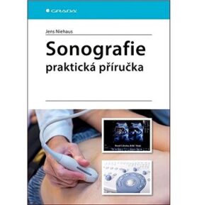 Sonografie Praktická příručka