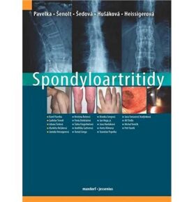 Spondyloartritidy
