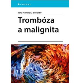 Trombóza a malignita