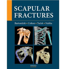 Scapular fractures