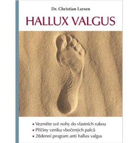 Hallux valgus