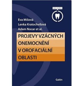 Projevy vzácných onemocnění v orofaciální oblasti