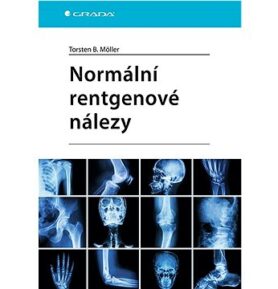 Normální rentgenové nálezy
