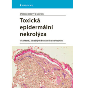Toxická epidermální nekrolýza: v kontextu závažných bulózních onemocnění
